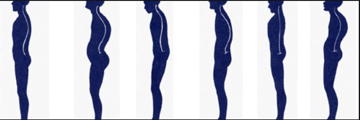 Postural Analysis and Correction